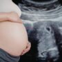 Private Baby Scans: Reassurance or Risk? What Expecting Mothers Aren't Being Told pvt baby scans